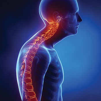Kyphoplasty for spine compression fracture - Synergy in Houston