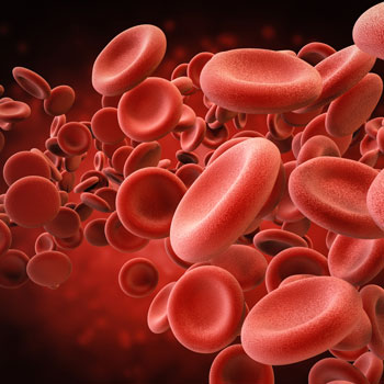 Pseudoaneurysm Thrombin Blood Cell Image - SVI in Houston
